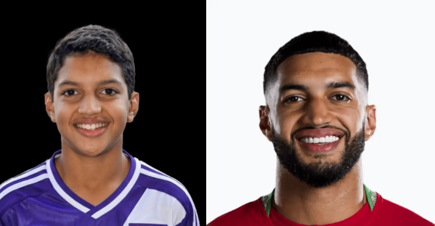 Ismael Saibari teeth